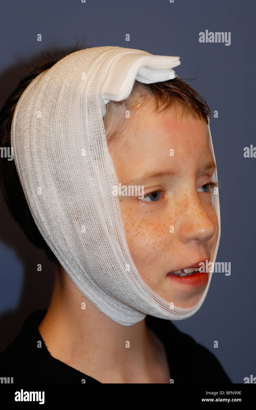 Scalp laceration repaired with staples on young boy who was seen in the