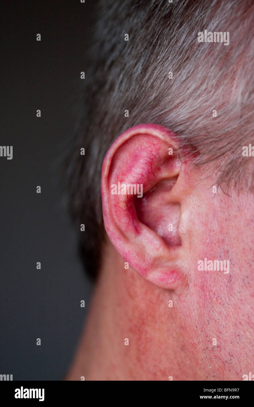 Hurt ear on man . Stock Photo