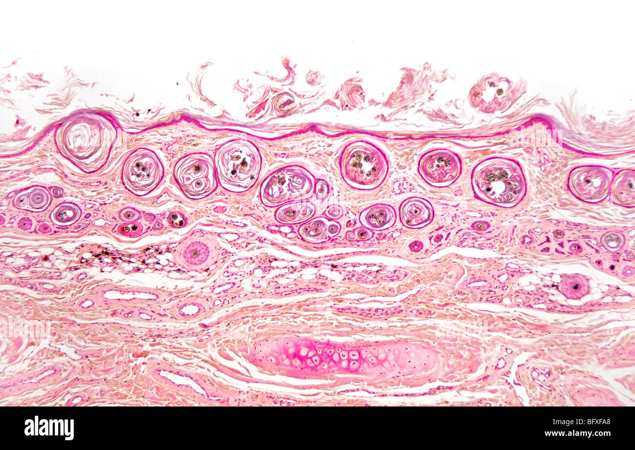 Mammalian hair follicle detail in outer skin, brightfield photomicrograph Stock Photo