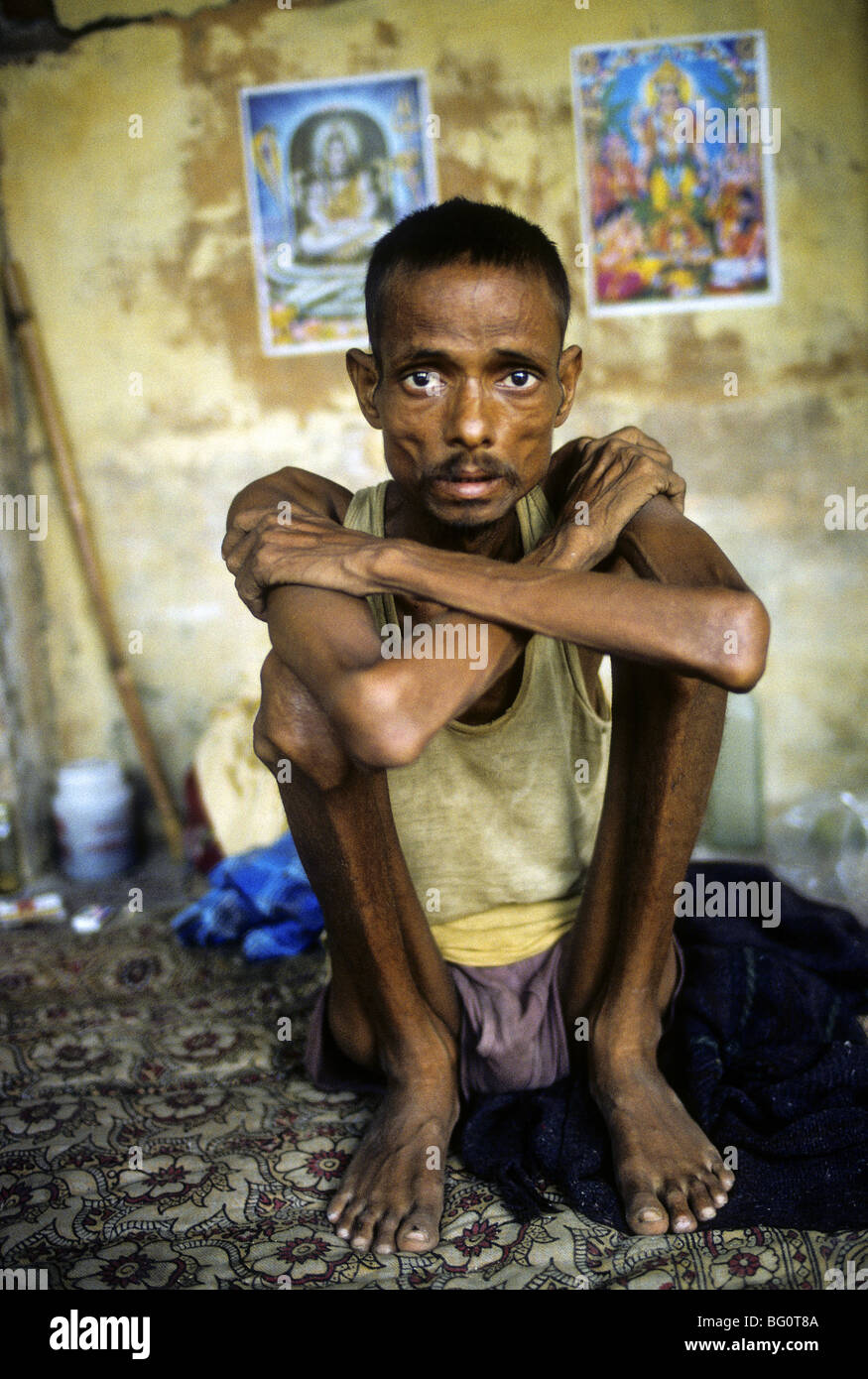 Portrait of an young man with Aids in his home in Mumbai, India Stock Photo