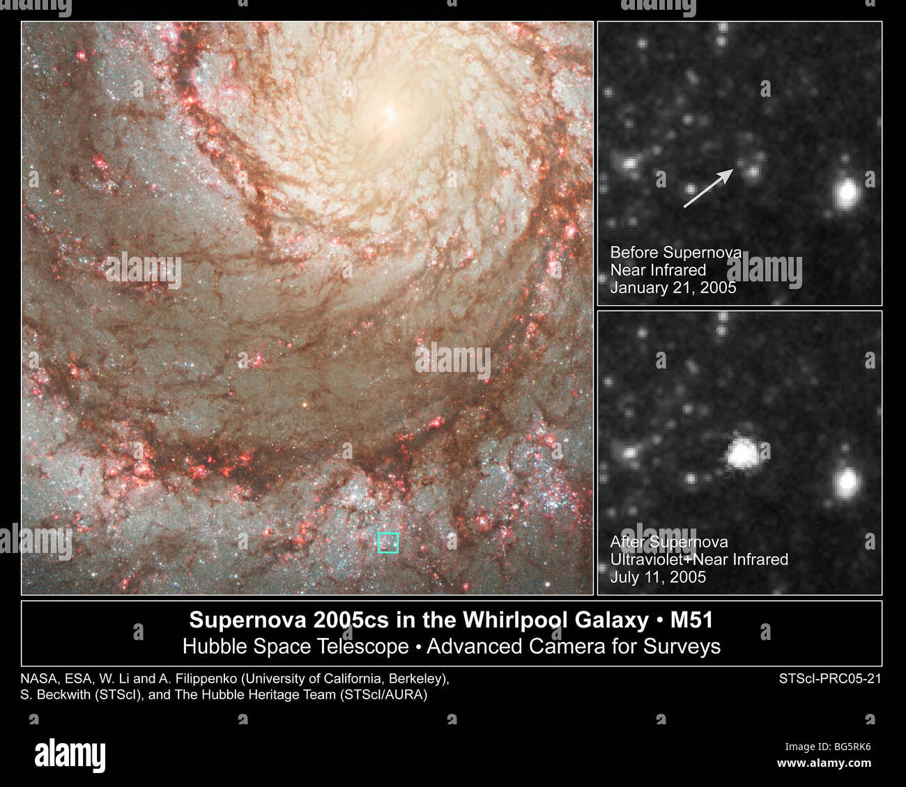 Supernova in the Whirlpool Galaxy M51 photographed by the Hubble Space Telescope including before and after inset pictures. Stock Photo