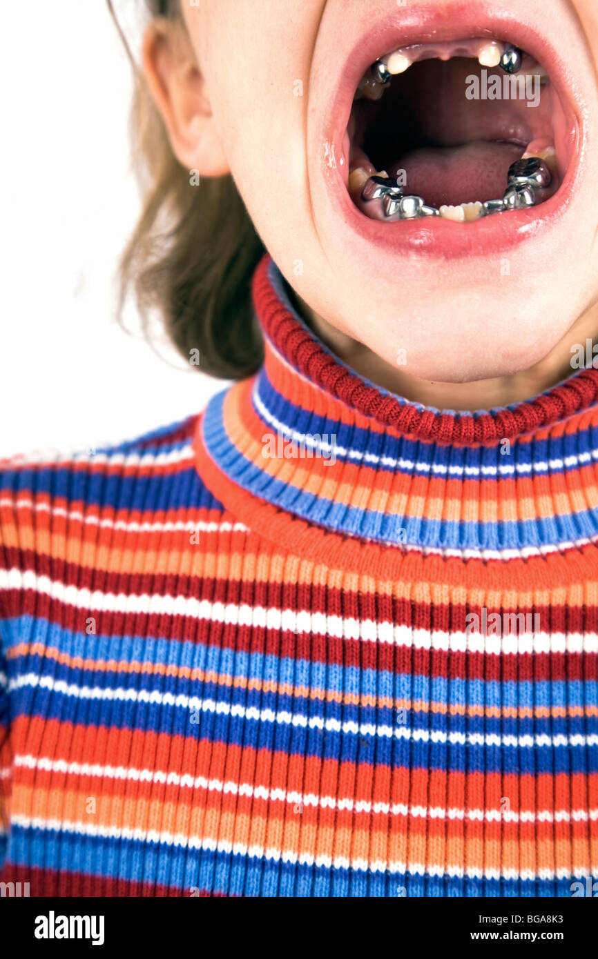 Silver tooth girl hires stock photography and images Alamy