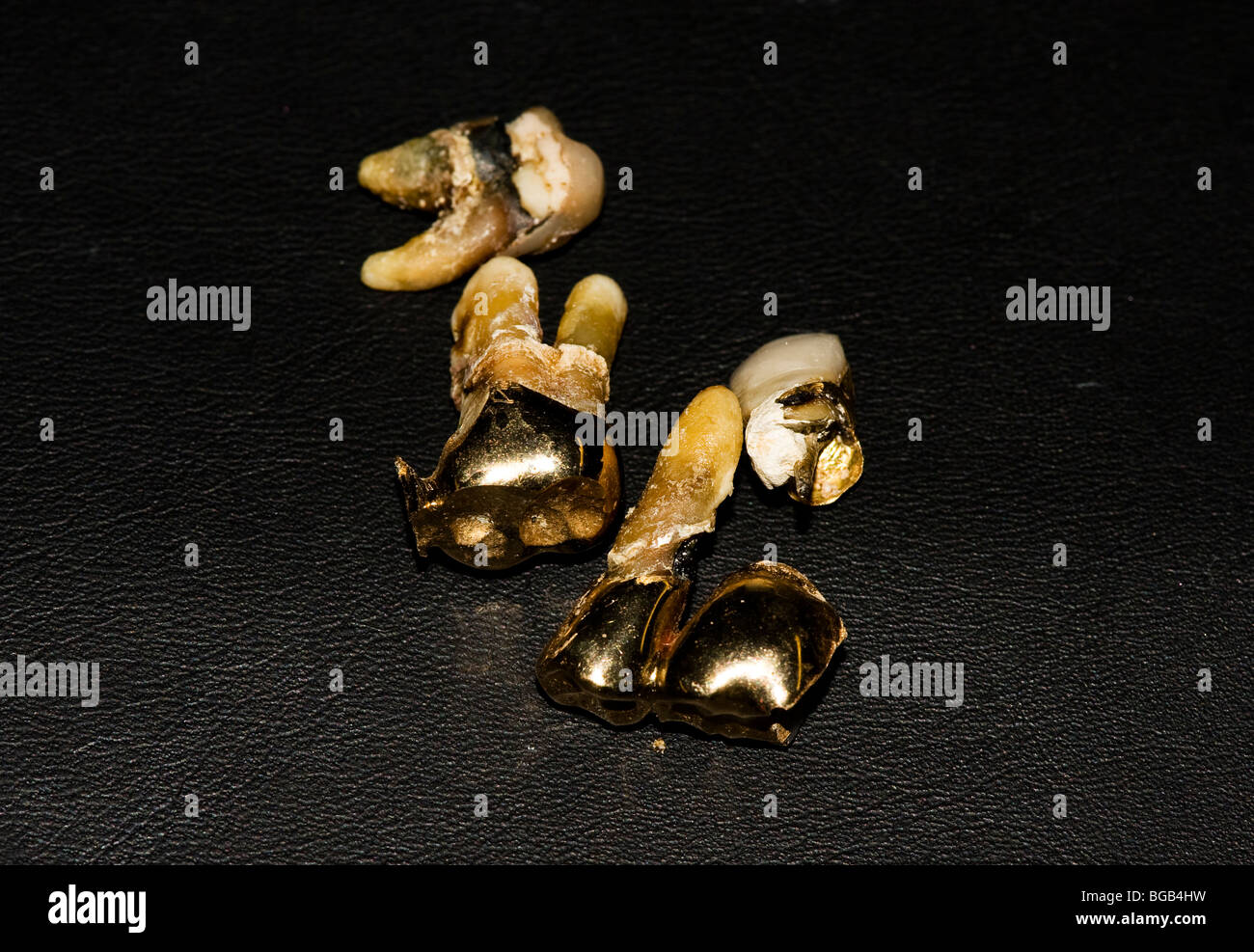 Tooths with gold Stock Photo