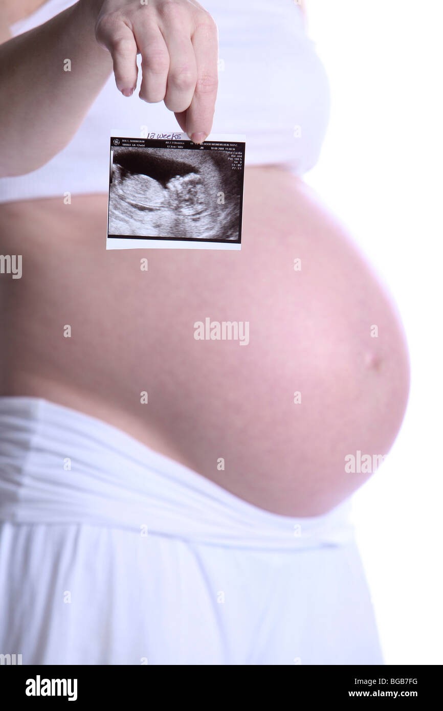 Ultrasound photographs hi-res stock photography and images - Alamy