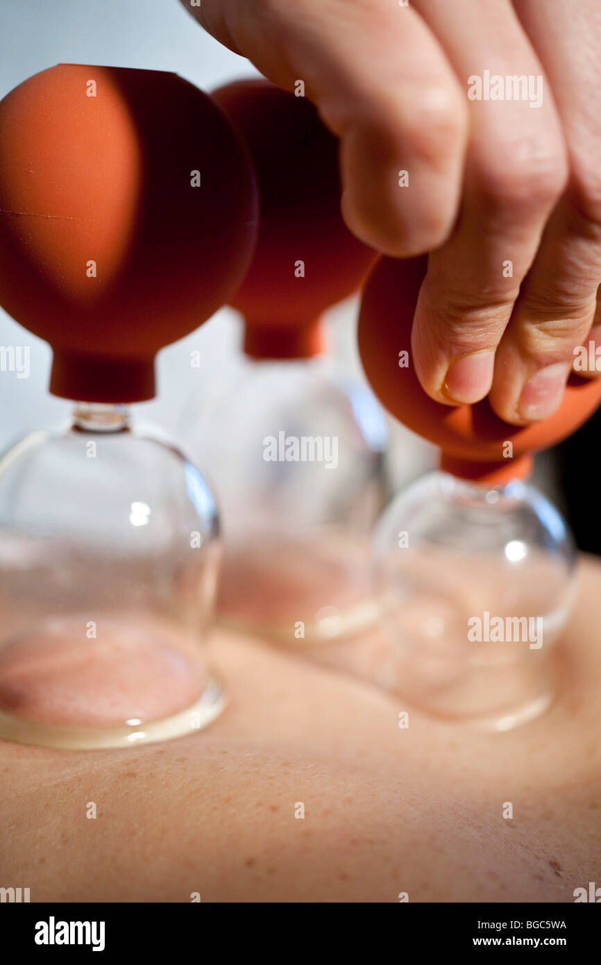 Cupping glas hires stock photography and images Alamy