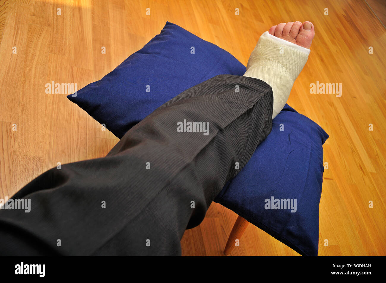 Detail of a man's broken leg in a plaster cast, resting on a cushion Stock Photo