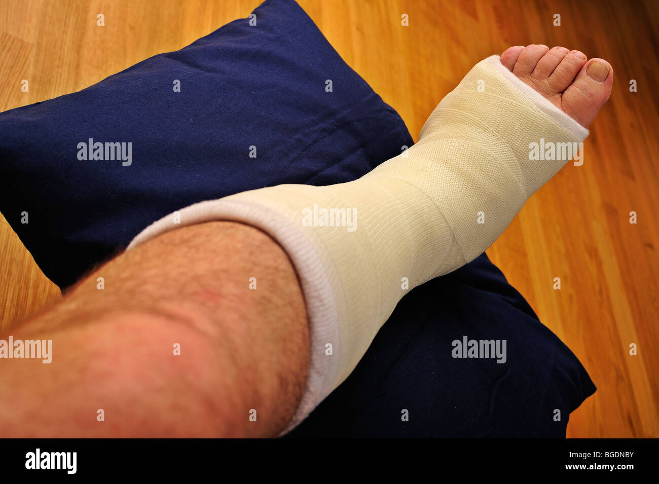 Detail of a man's broken leg in a plaster cast, elevated on a cushion Stock Photo