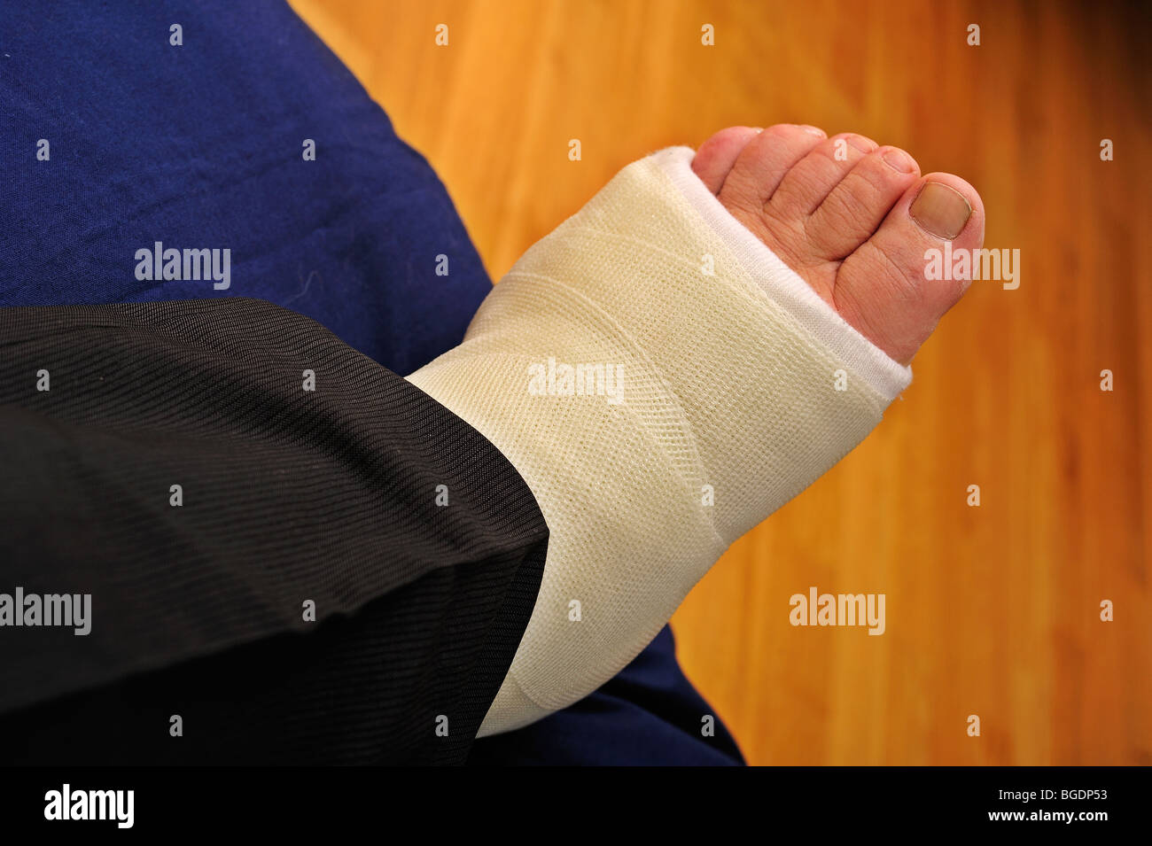 Detail of a man's broken foot in a plaster cast, resting on a cushion