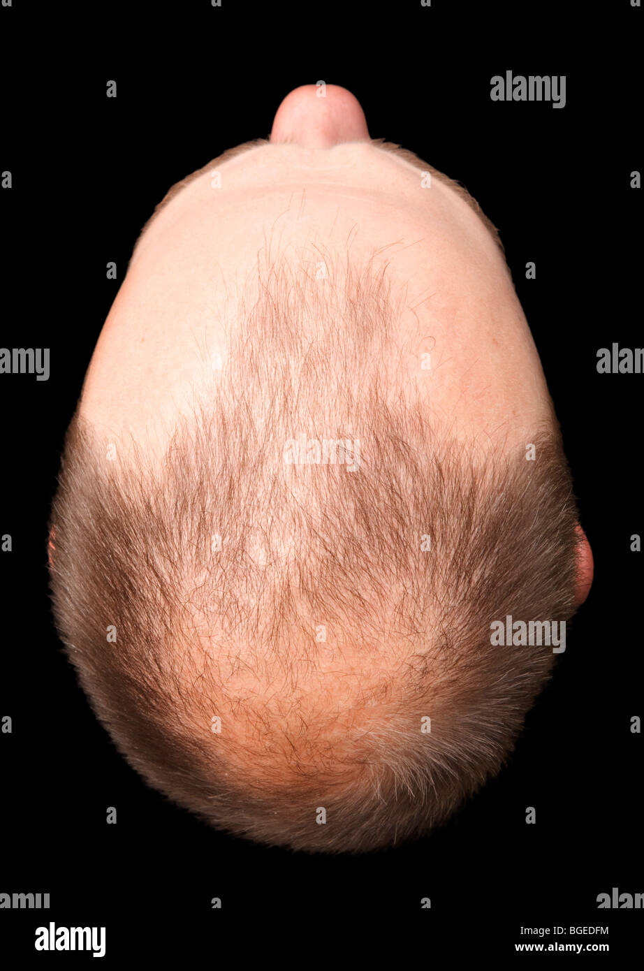 A balding head viewed from above, isolated against a black background Stock Photo