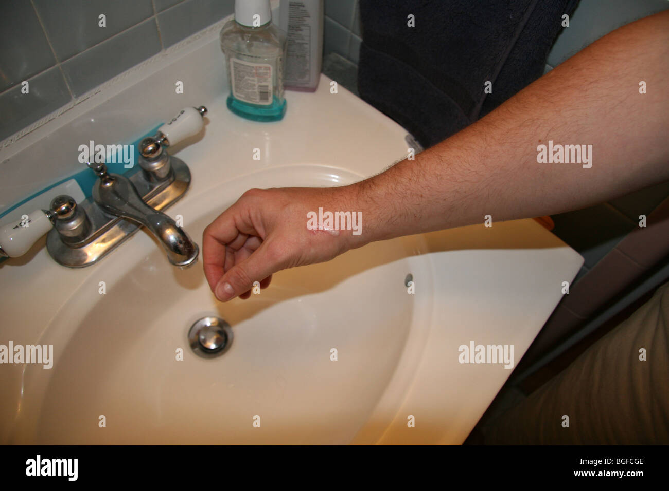 Hydrogen peroxide wound hires stock photography and images Alamy