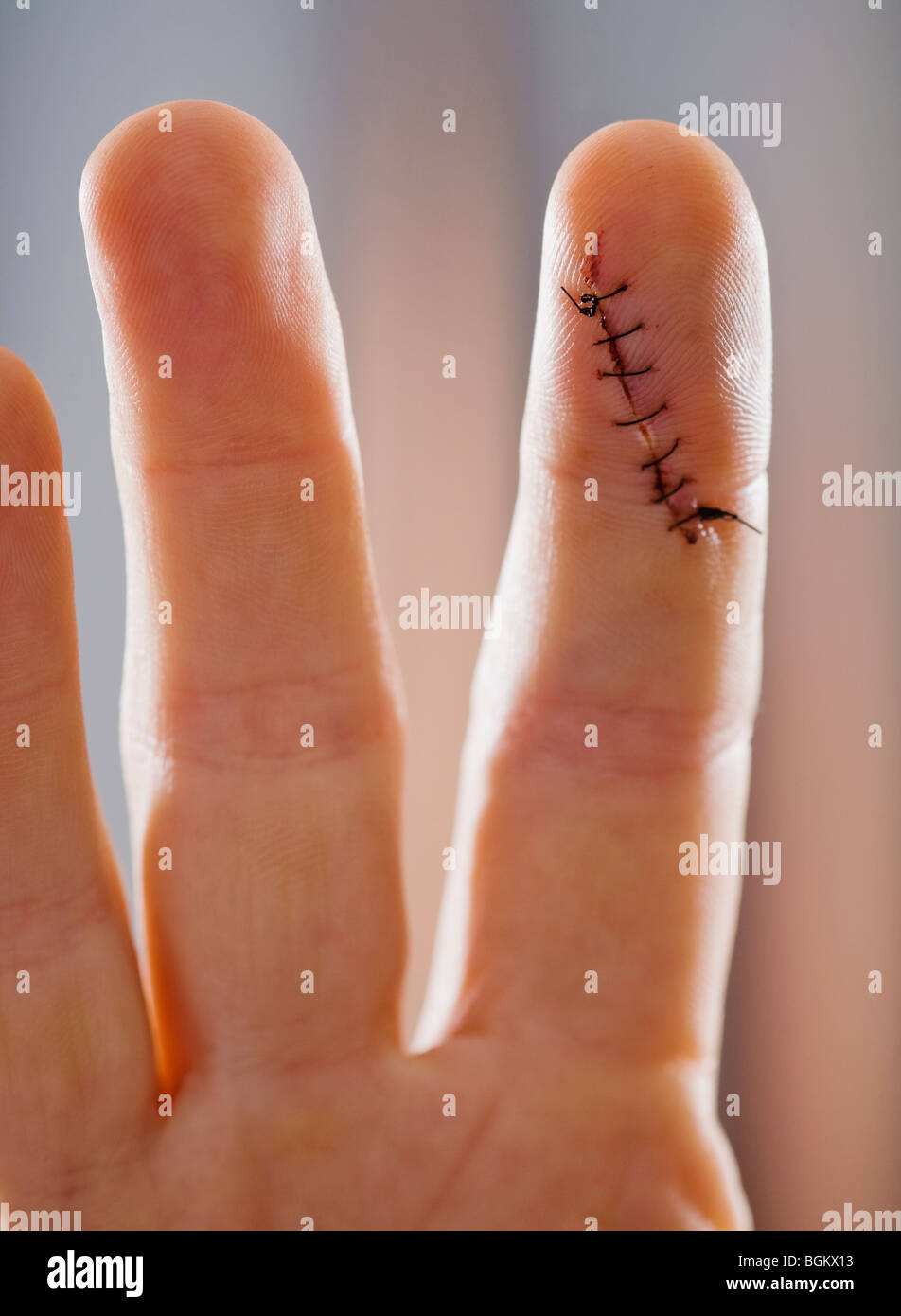 Stitches cut hires stock photography and images Alamy
