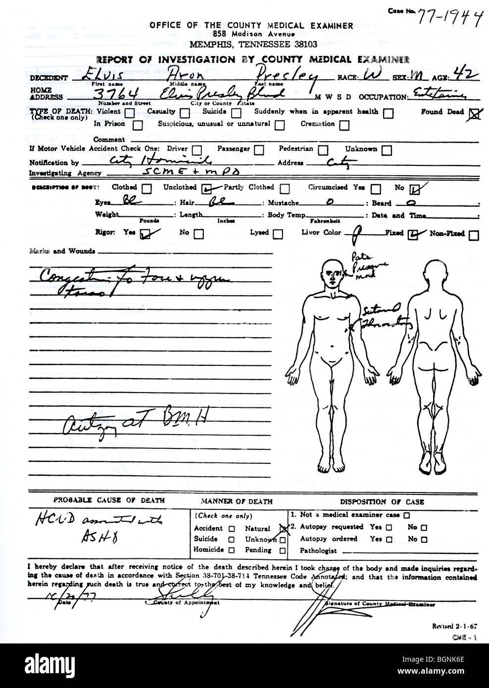ELVIS PRESLEY - First page of the autopsy report issued by the Memphis County Medical Examiner after his death in 1977 Stock Photo