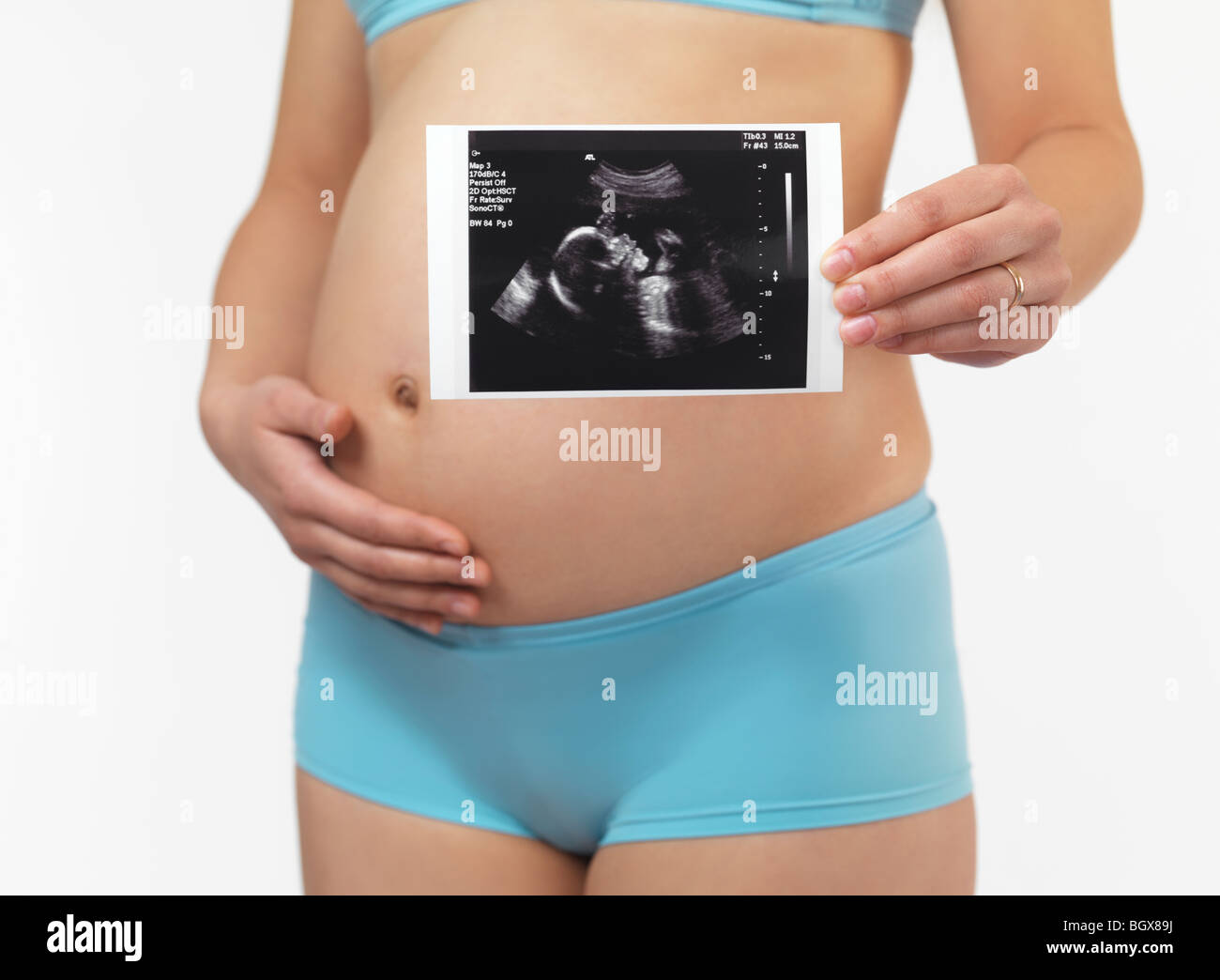 Pregnant woman holding ultrasound imaging picture of her baby. Five months old fetus. Isolated on white background. Stock Photo