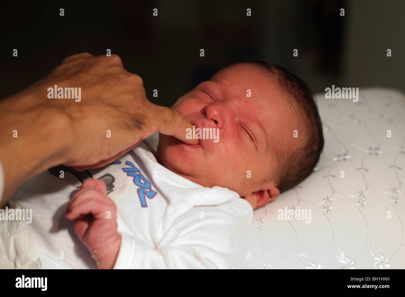 Baby Circumcision Before And After