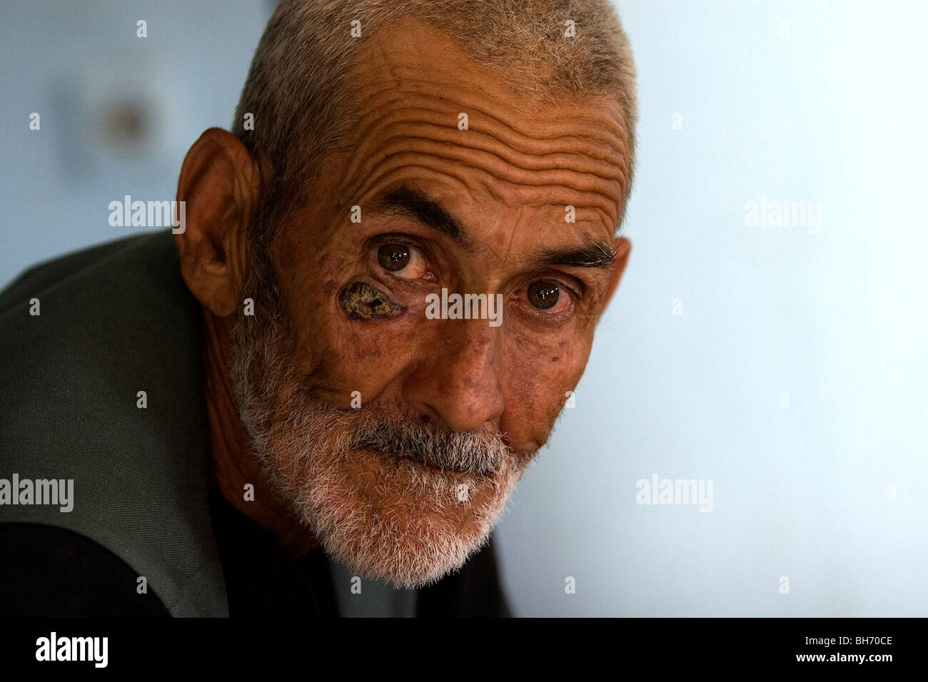Disturbed Patient Mentally disturbed person hi-res stock photography and images - Alamy