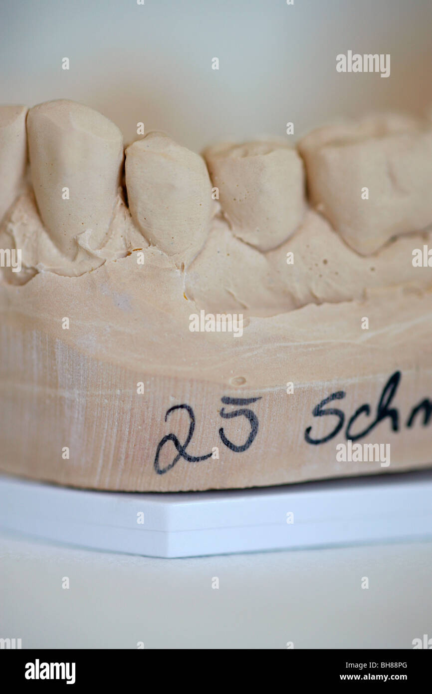 Detail of a dental molding Stock Photo Alamy