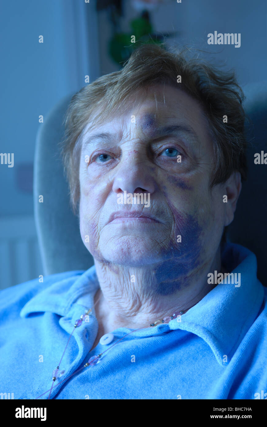 Elderly Womens Injured After Fall. Stock Photo