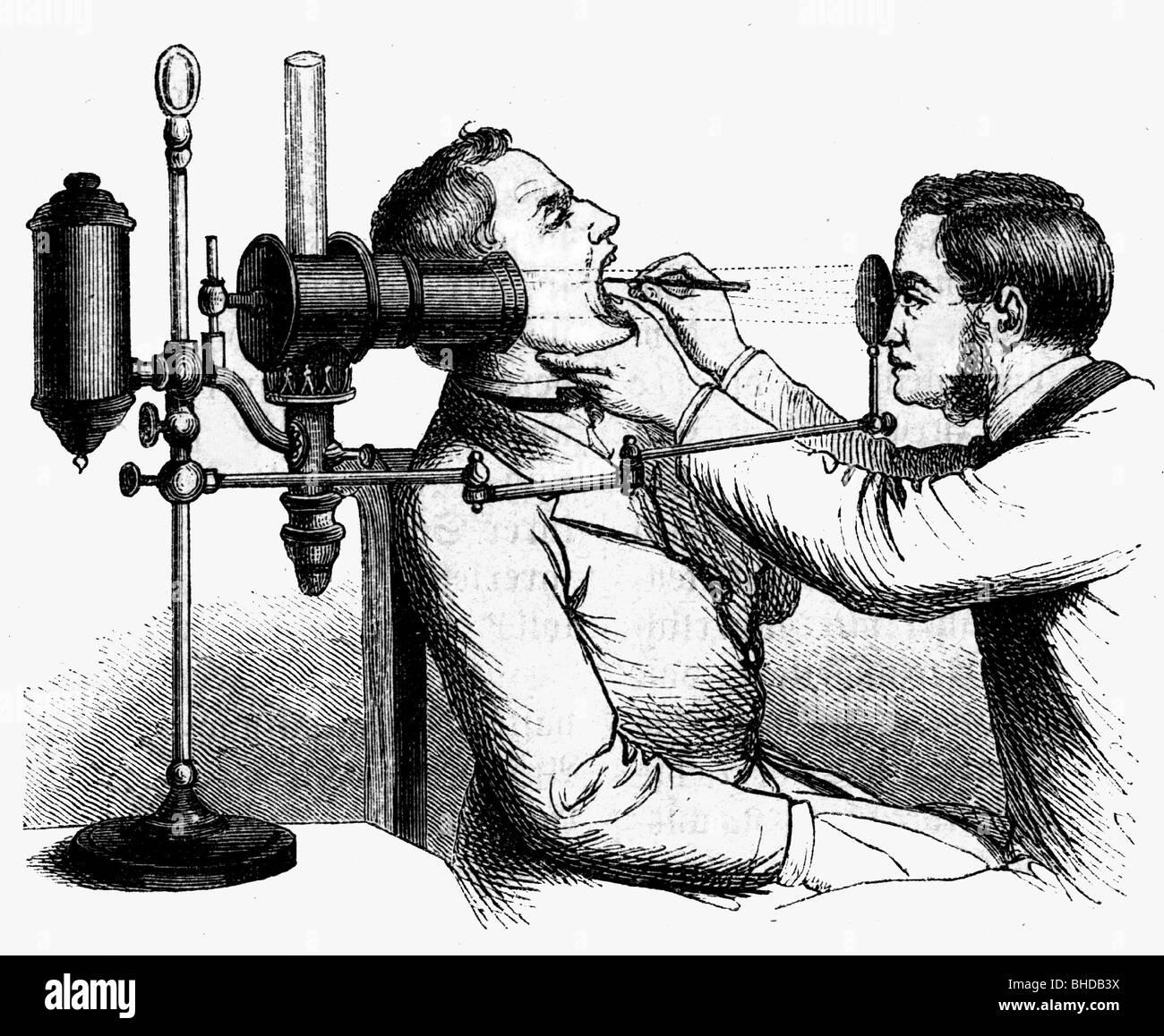 medicine, treatments, neck, synthetic lighting of the larynx, wood engraving, 1875 Stock Photo