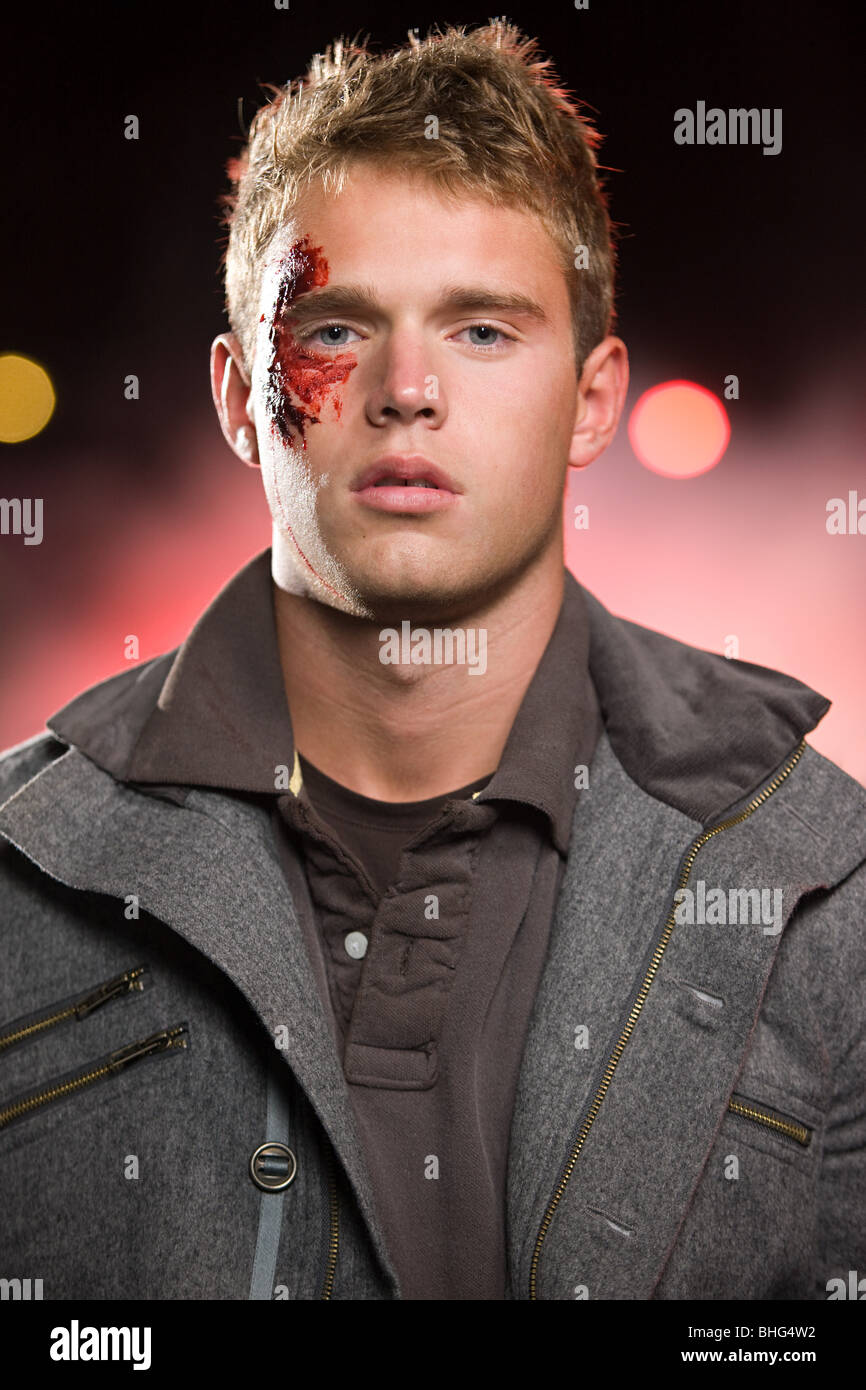 Teenage boy with facial injuries Stock Photo