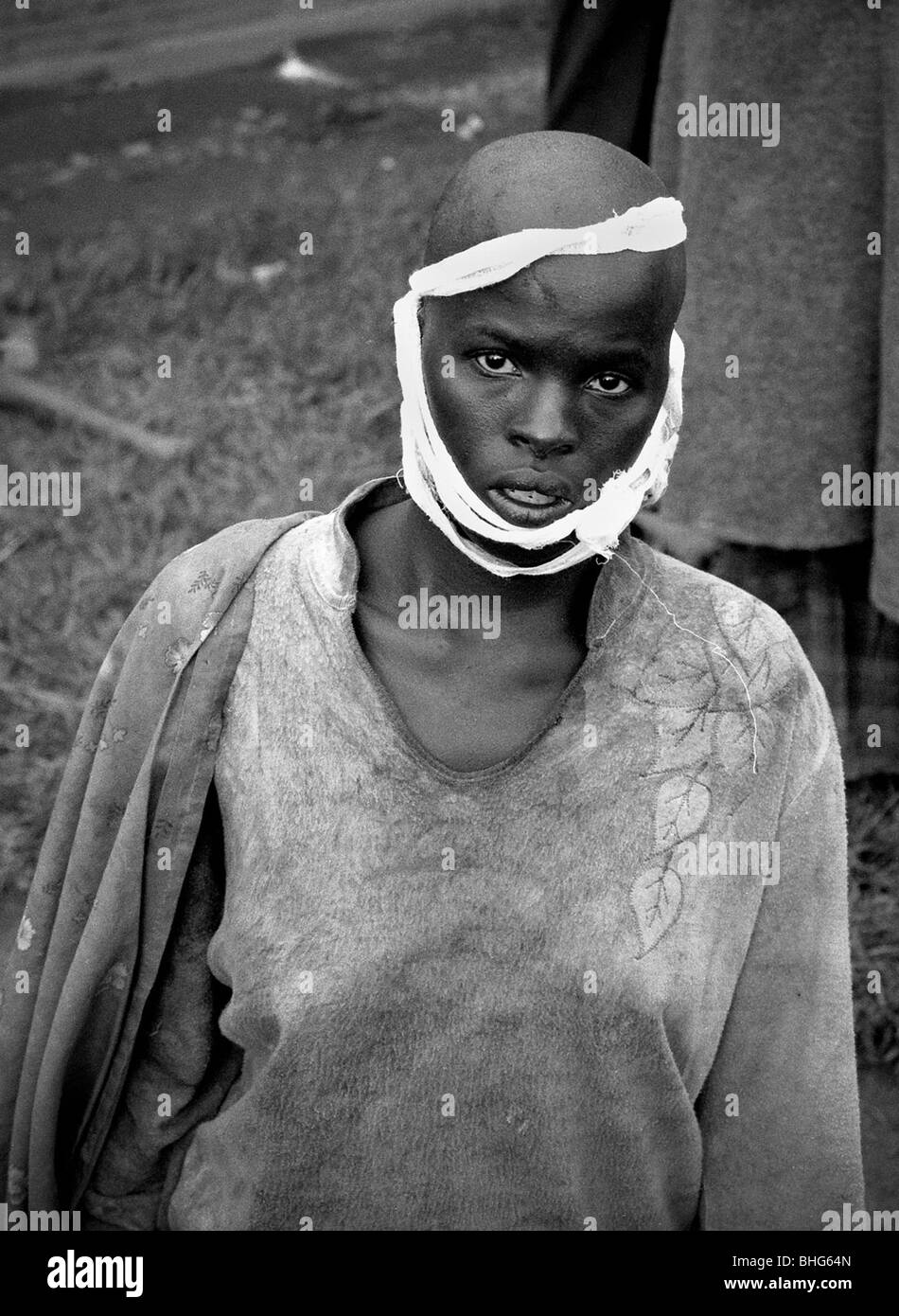 Tutsi woman with the back of her neck slashed with machete in Rwanda 1994 Stock Photo