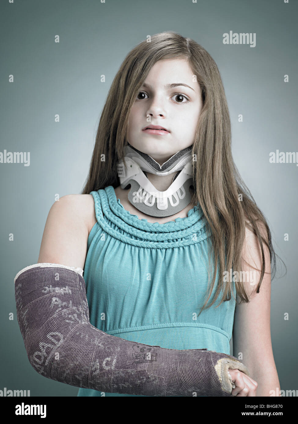 Long arm cast hires stock photography and images Alamy
