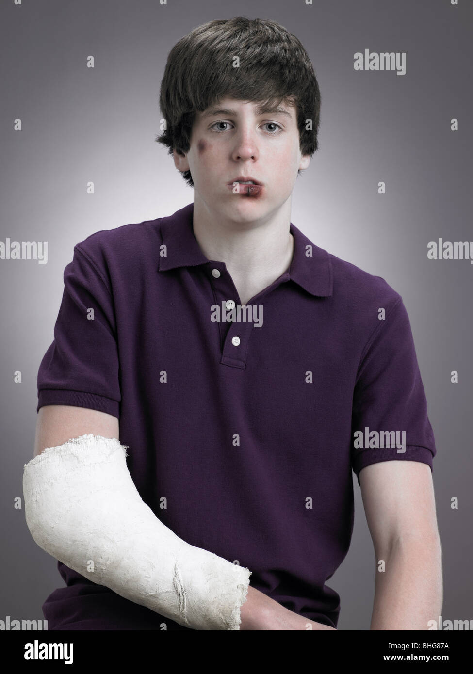 Boy with arm in plaster Stock Photo