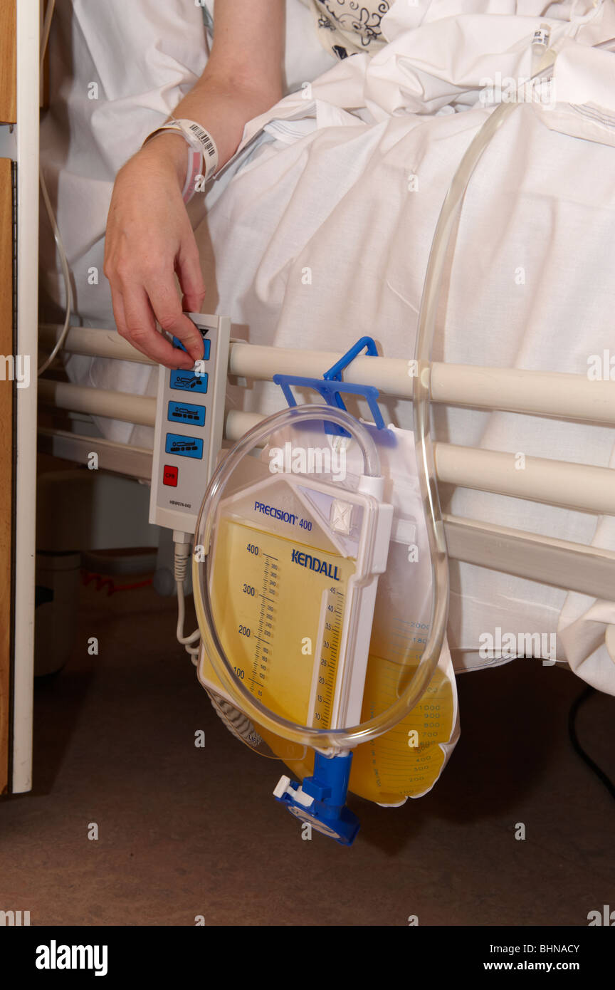 hospital-catheter-urine-bag-strapped-to-side-of-bed-BHNACY.jpg