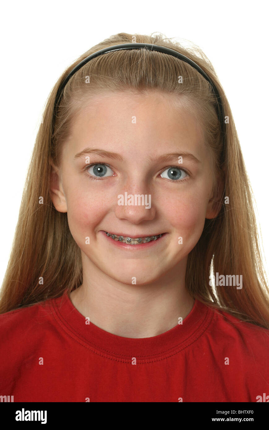 young-girl-with-dental-braces-on-her-teeth-isolated-on-white-BHTXF0.jpg