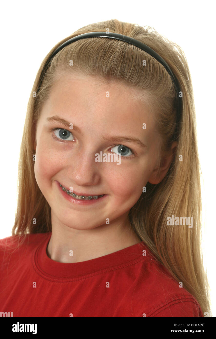 girls braces Young girl with dental braces on her teeth isolated on white Stock Photo -  Alamy