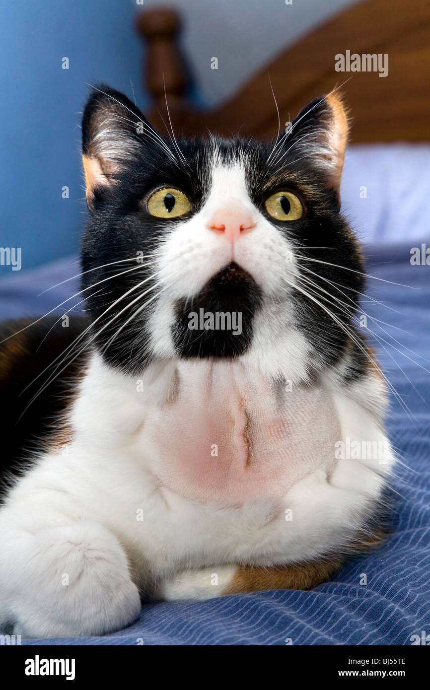 Overactive thyroid hires stock photography and images Alamy