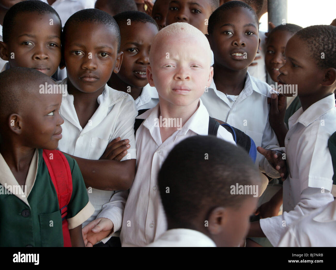 Albino boy with black pupils in a school in Mariannhill, South Africa. In Africa, prosecution of albinos is not uncommon Stock Photo