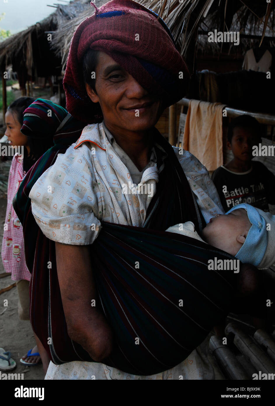 disabled karen refugee with no hands carrying  baby,umpium refugee camp(thai burmese border) , south of mae sot , tak,thailand Stock Photo