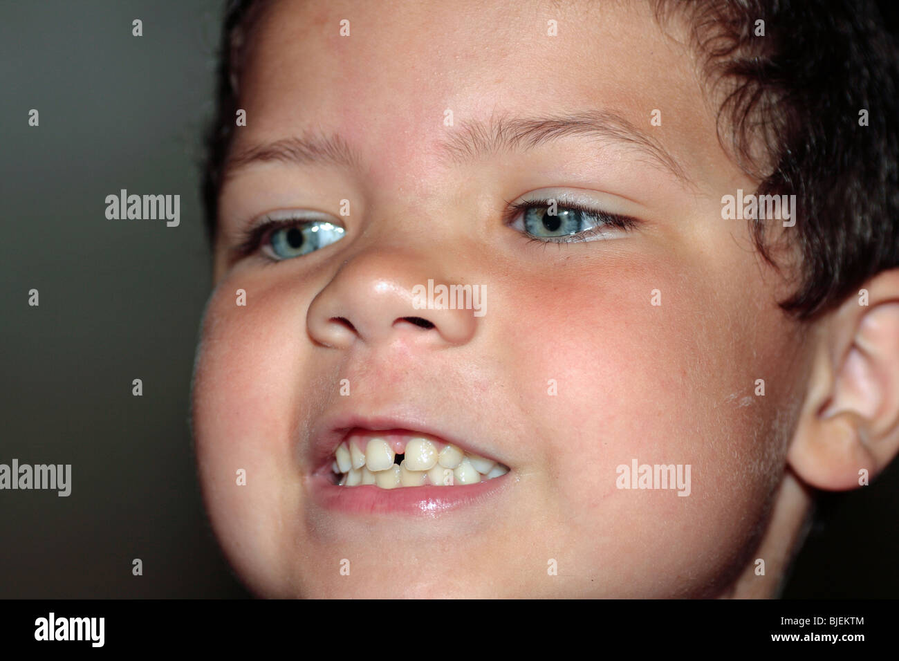 a four year old child boy showing his teeth Stock Photo