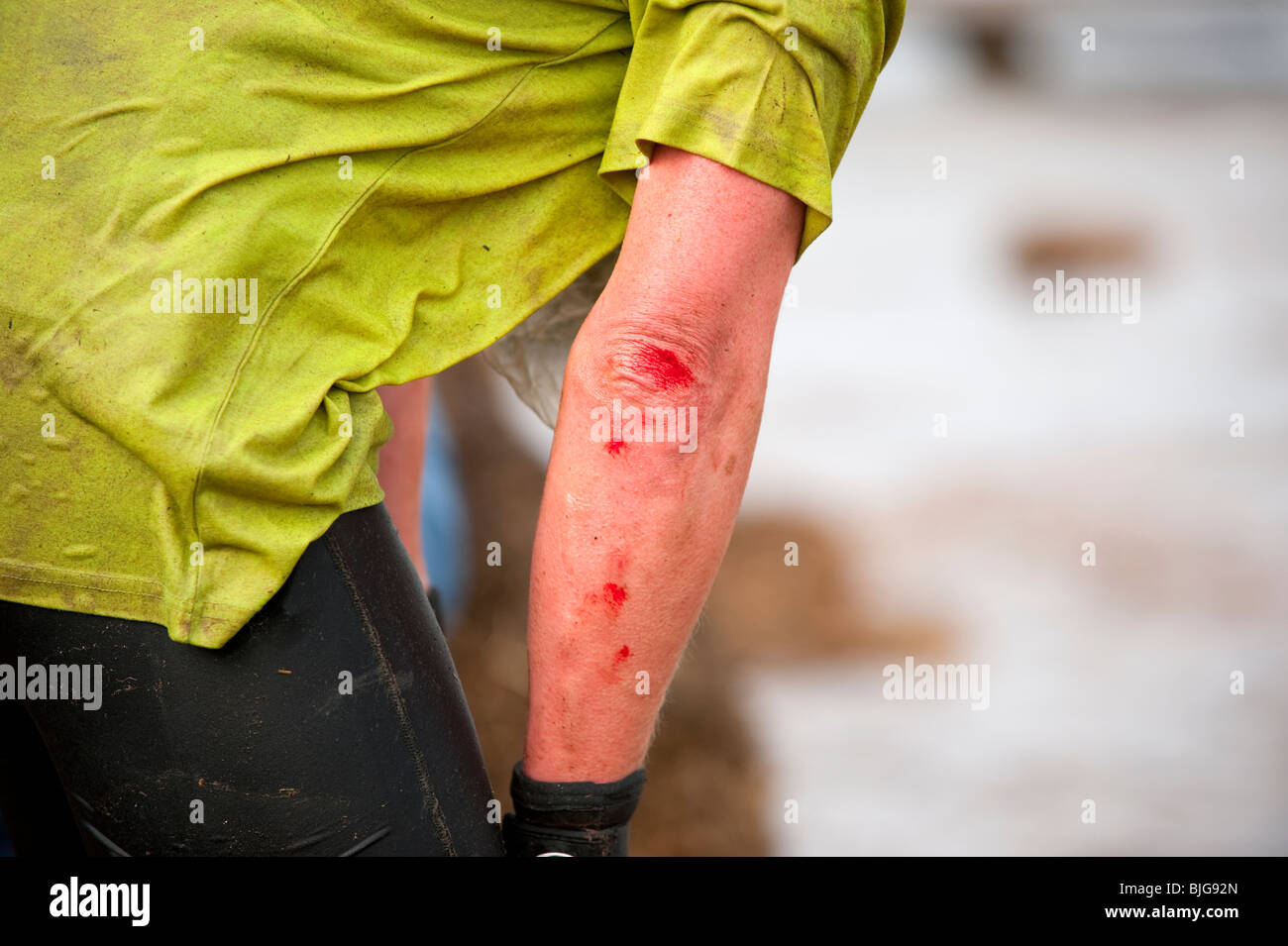 Arm Cut Images – Browse 519,143 Stock Photos, Vectors, and Video