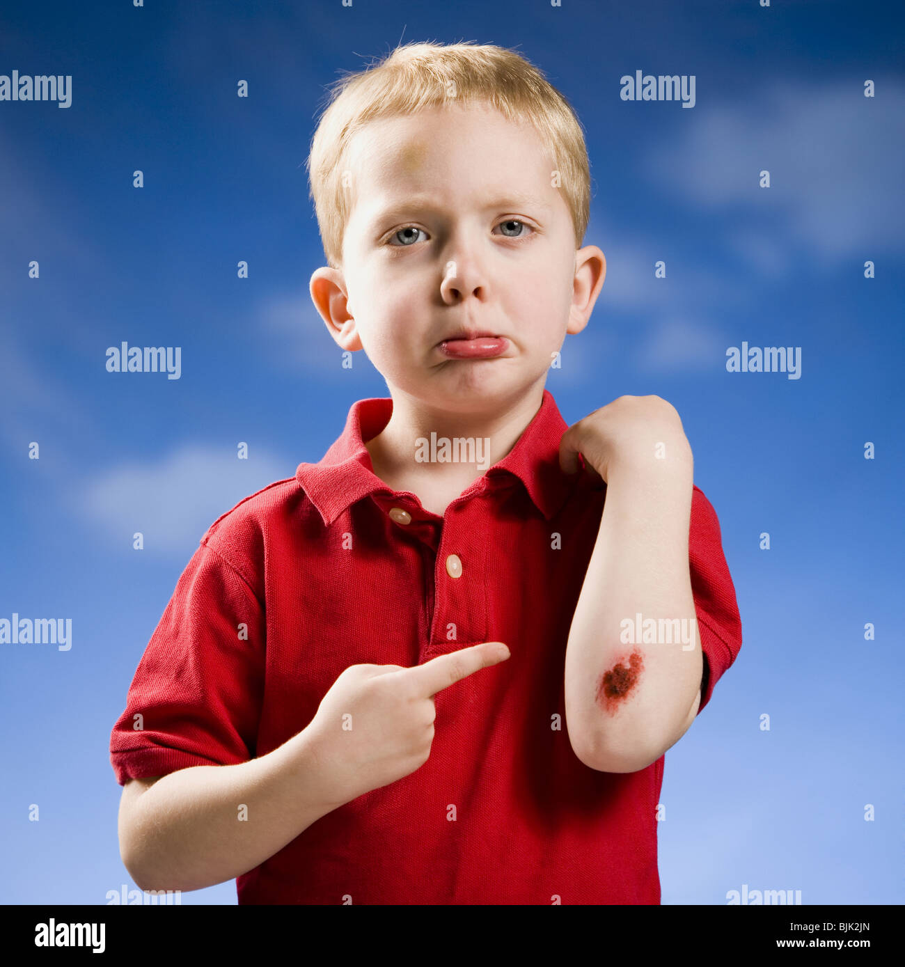 Boy with scraped elbow Stock Photo Alamy