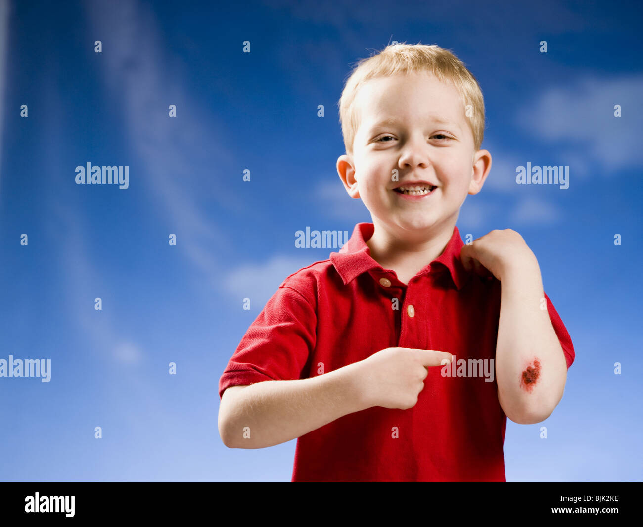 Boy with scraped elbow Stock Photo Alamy