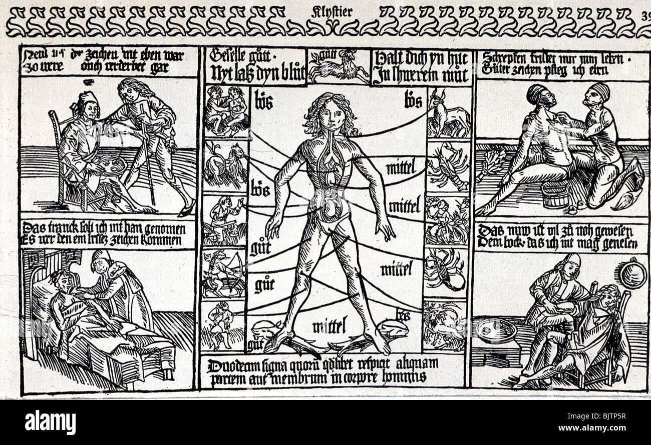 Medieval blood letting hires stock photography and images Alamy