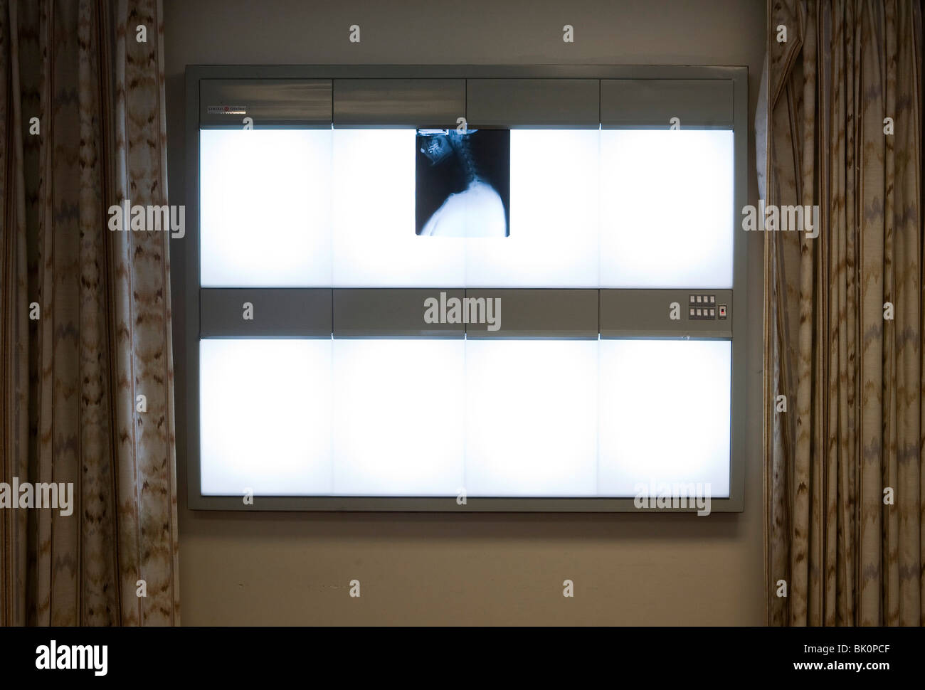 Xrays in a doctors office Stock Photo Alamy