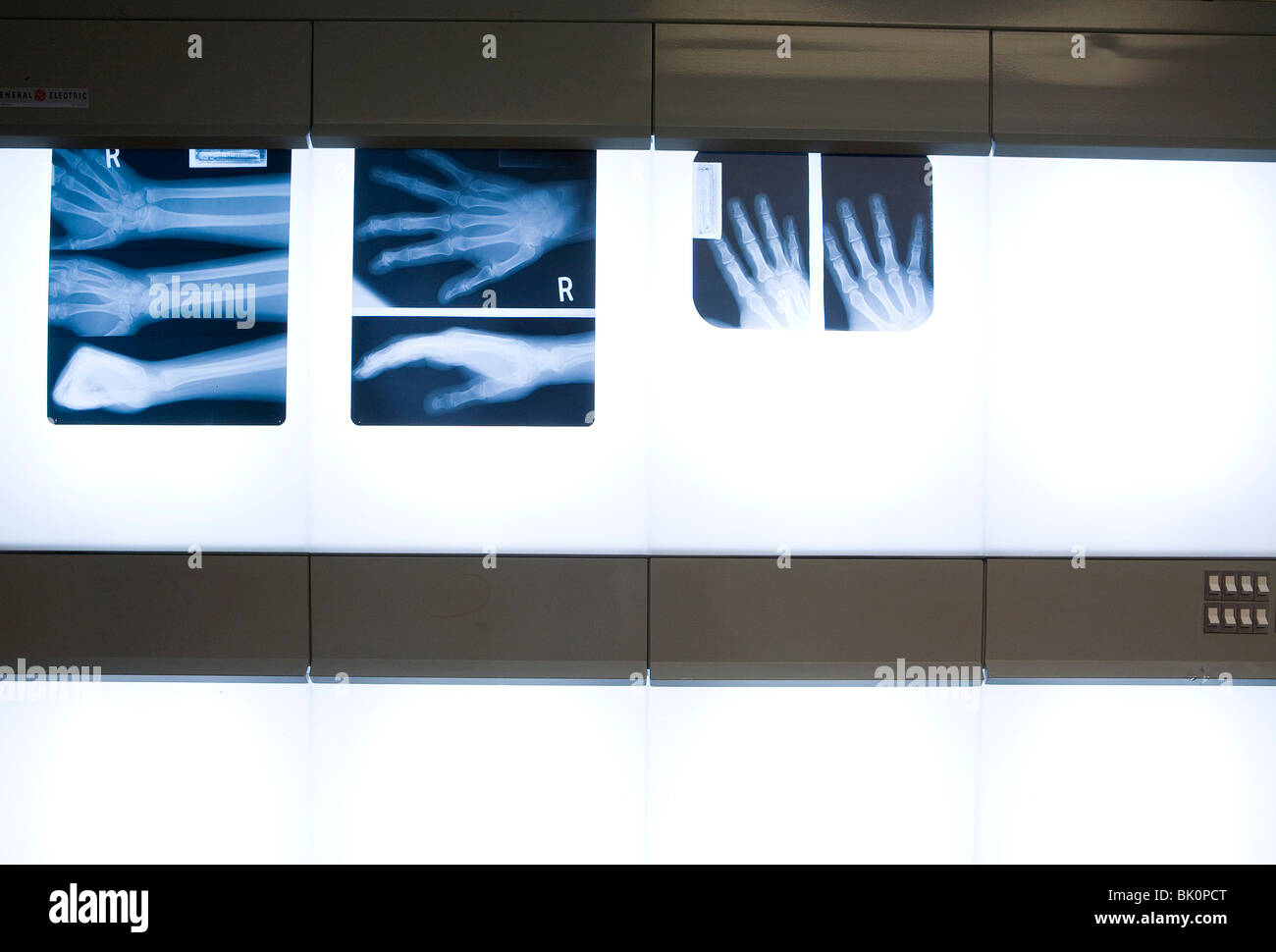 X-rays in a doctors office.  Stock Photo
