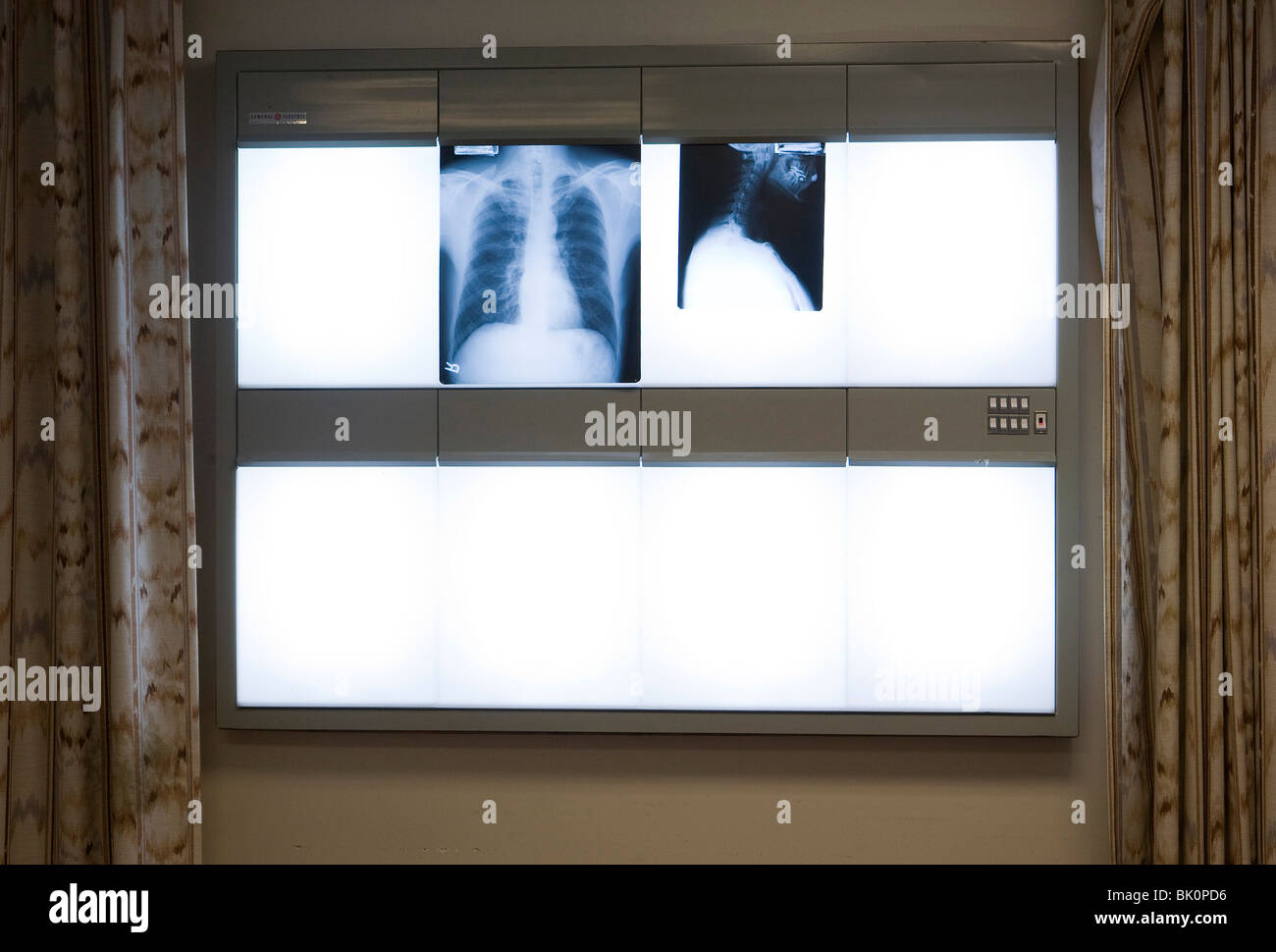 Xrays in a doctors office Stock Photo Alamy