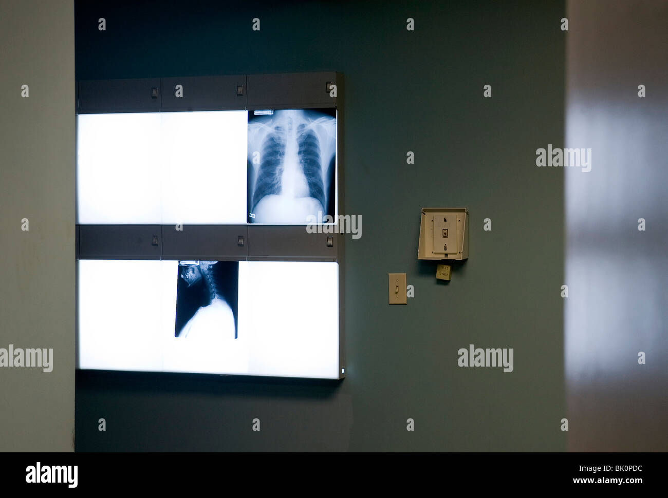 Xrays in a doctors office Stock Photo Alamy