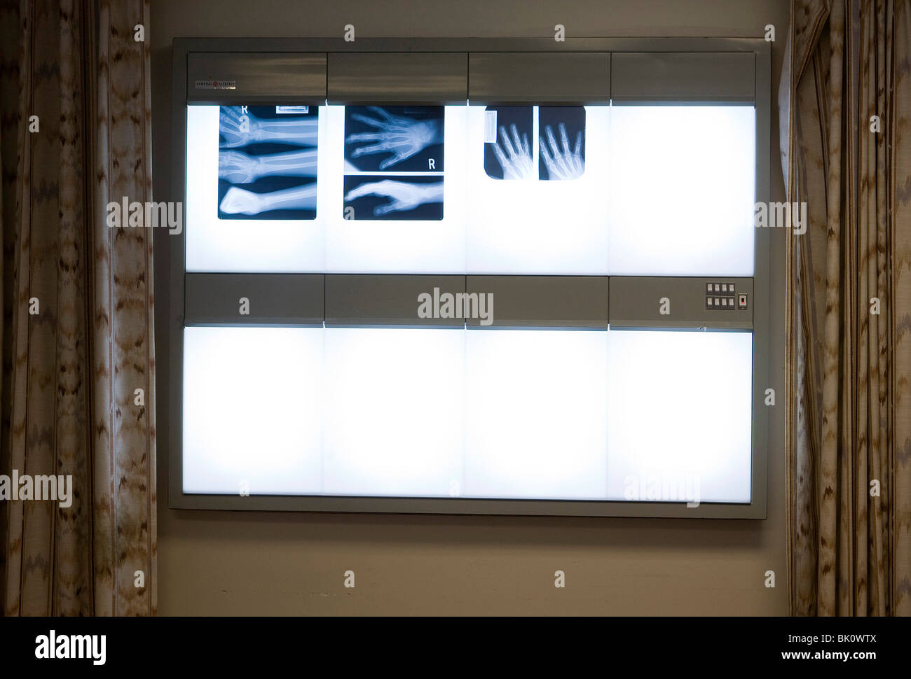 Xrays in a doctors office Stock Photo Alamy