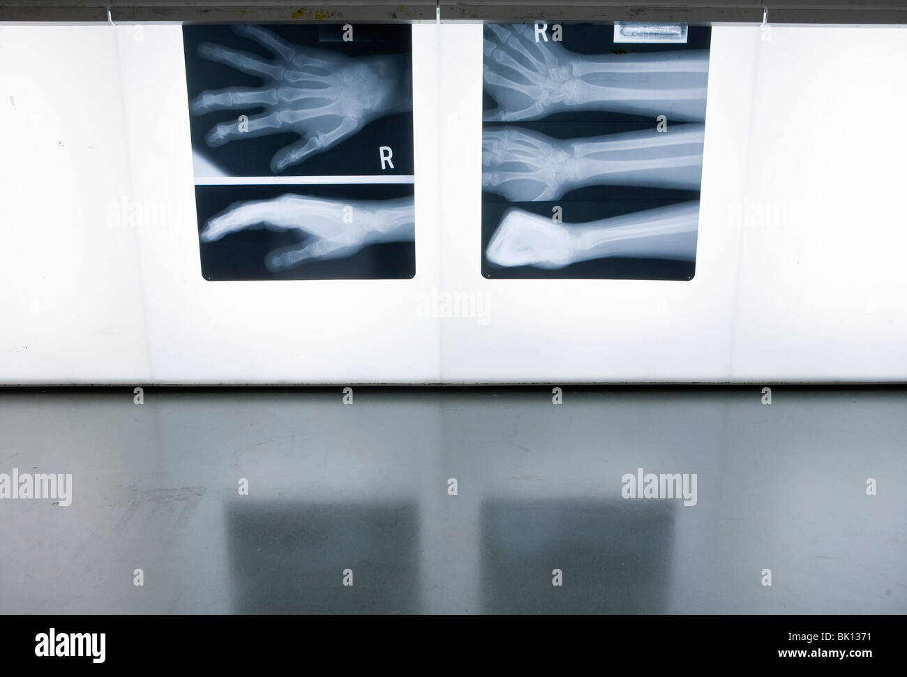 Xrays in a doctors office Stock Photo Alamy