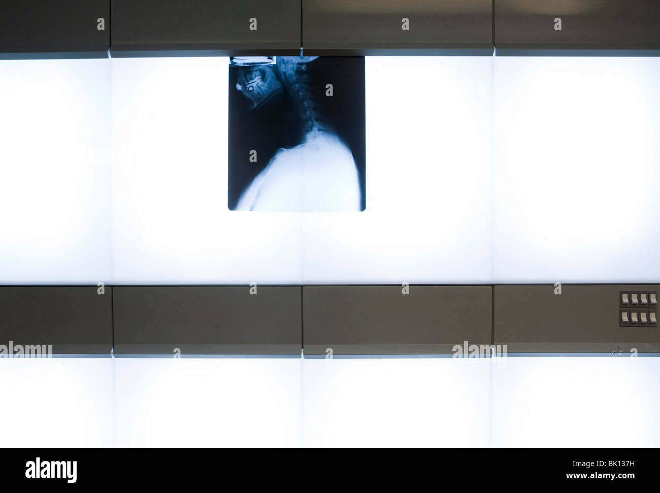 Xrays in a doctors office Stock Photo Alamy