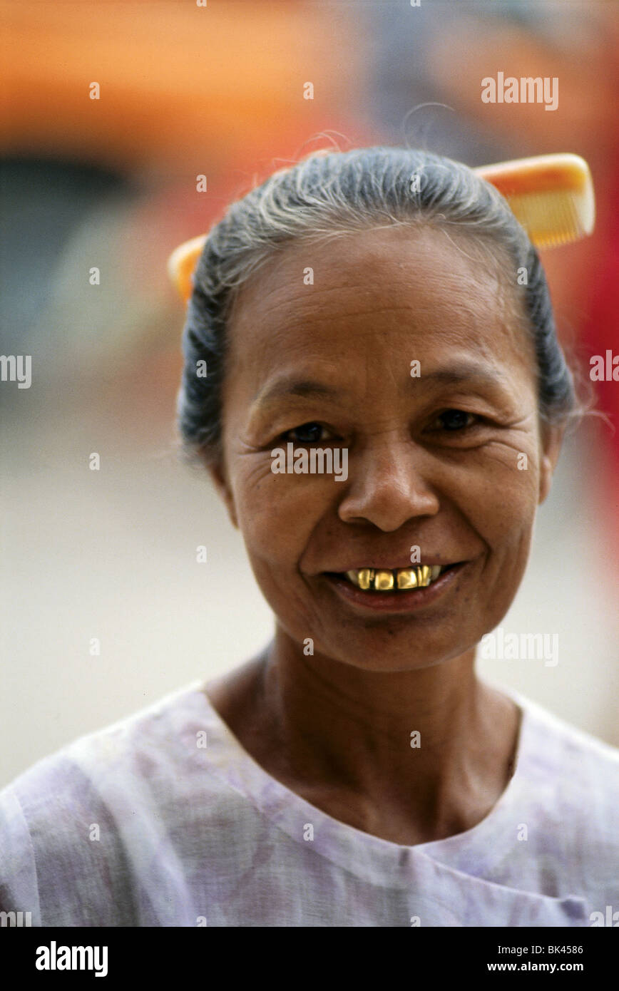 Gold Tooth Woman Stock Photos & Gold Tooth Woman Stock Images Alamy