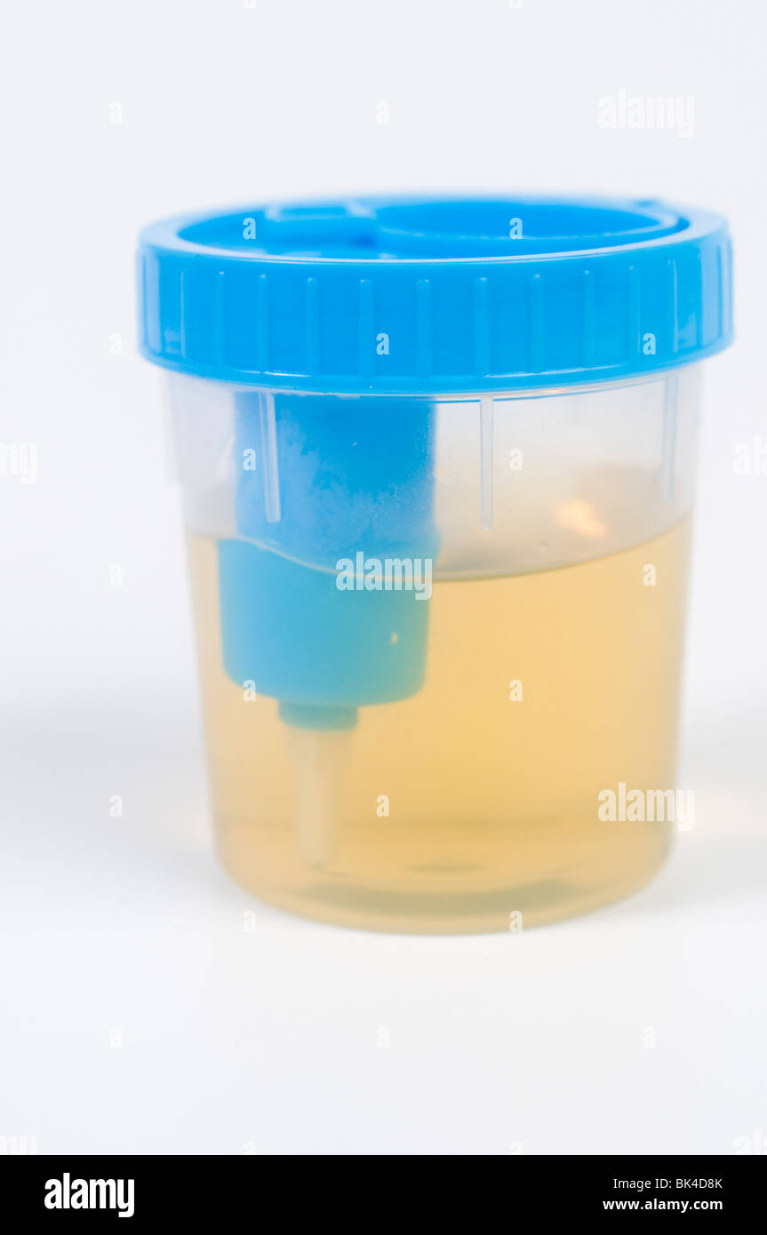 Cutout of an sterile Urine sample cup, containing a urine sample close-up on white background Stock Photo