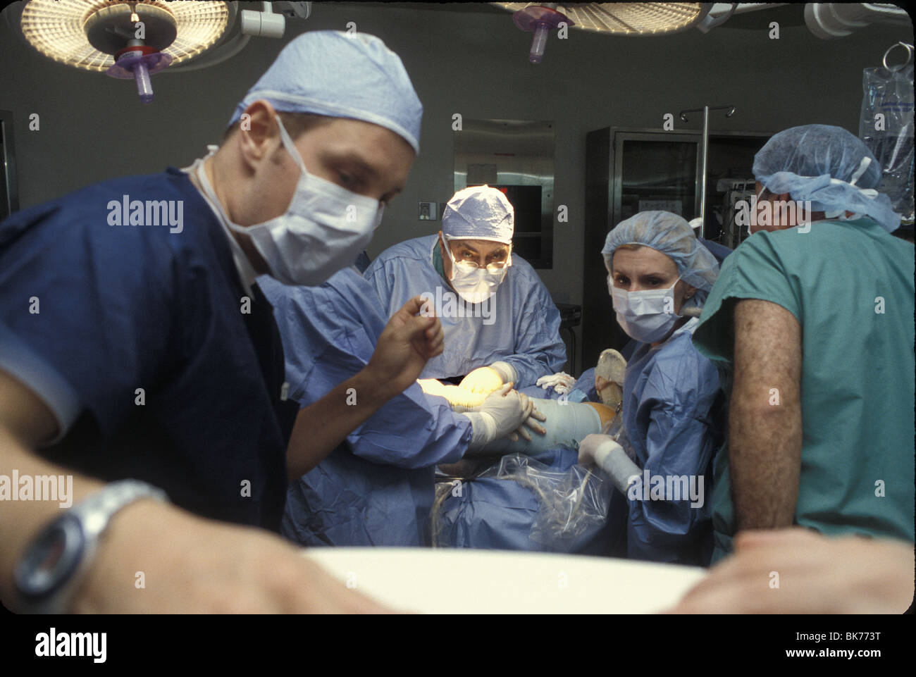 Special surgery for varicose veins. Surgeon and team looking into monitor seeing into the body by way of a very small camera. Stock Photo