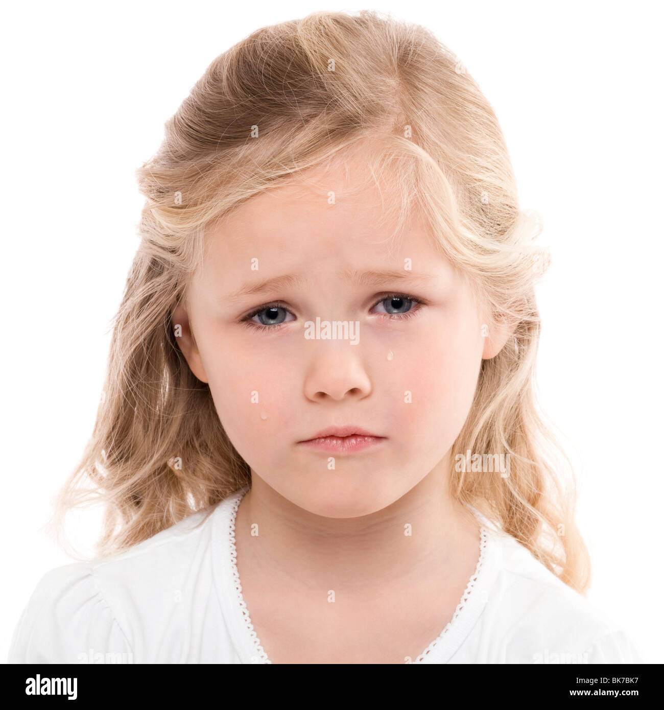 Ребенок 6 лет бледный. Бледность у детей. Бледная кожа у ребенка. Бледность кожных покровов у детей. Анемия у детей.
