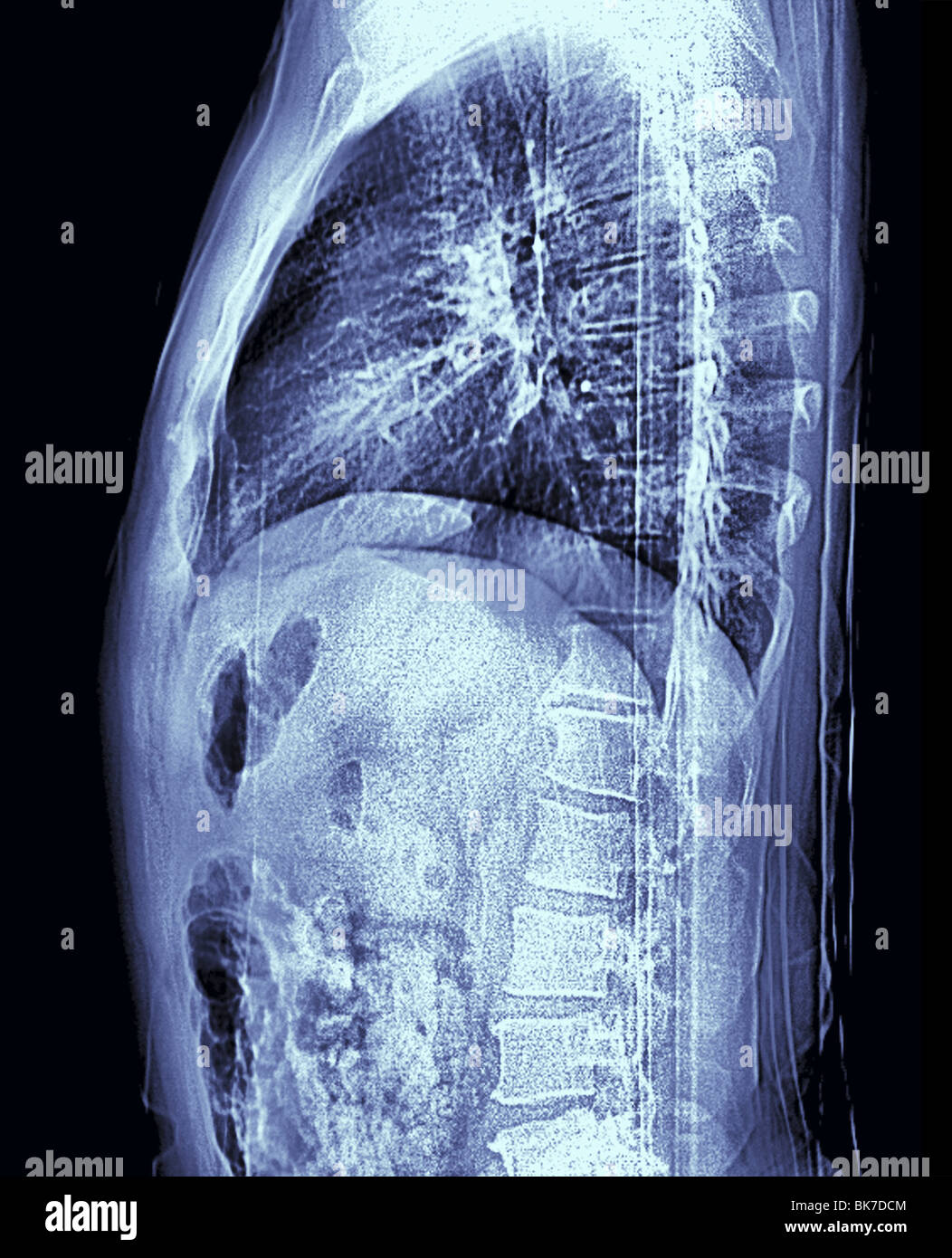 Human torso, MRI scan Stock Photo