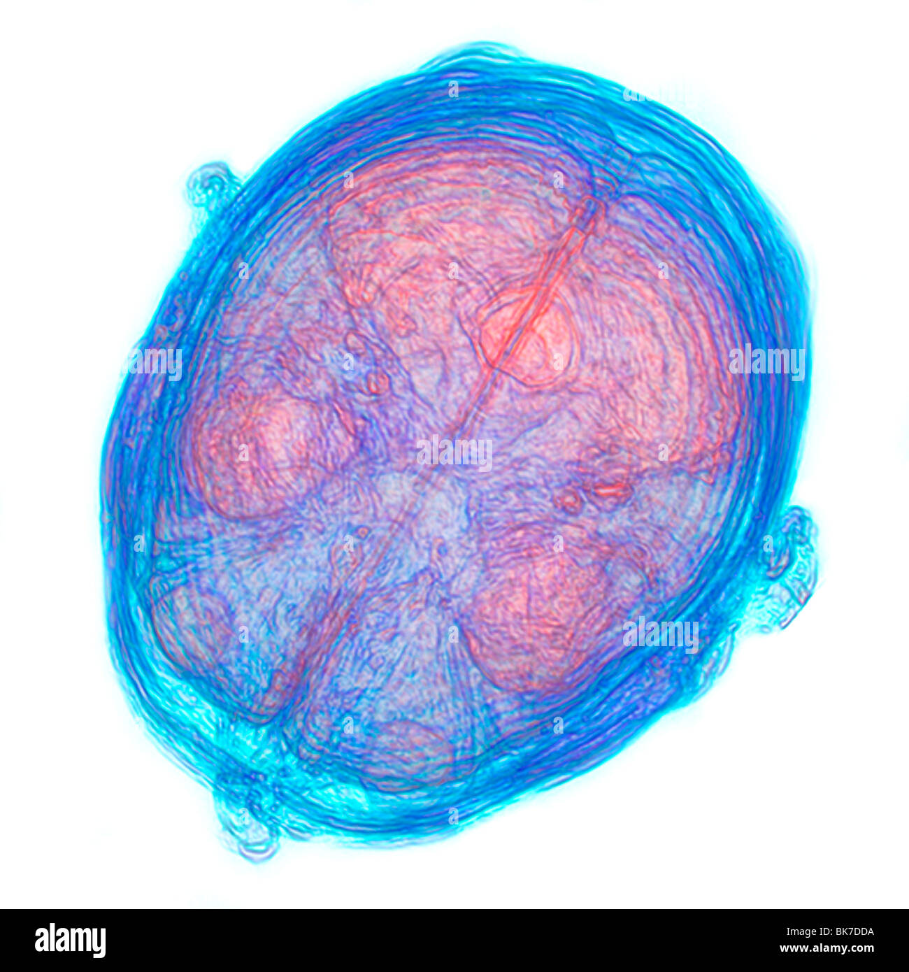 Human brain, 3D-MRI scan Stock Photo